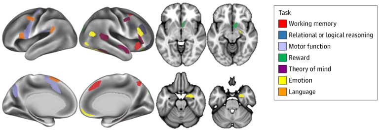 Brain Scan activation from cannabis use